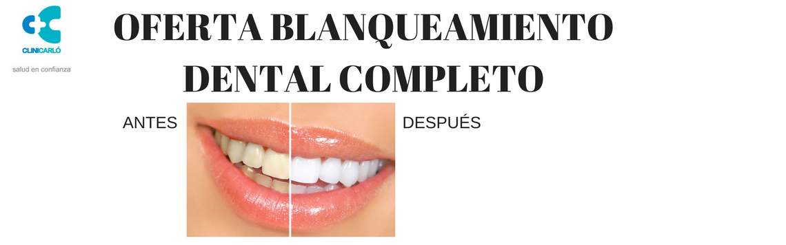 OFERTA BLANQUEAMIENTO DENTAL